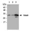 TP53 Induced Glycolysis Regulatory Phosphatase antibody, ALX-210-947-C100, Enzo Life Sciences, Western Blot image 