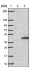 Cyclin Dependent Kinase 20 antibody, NBP1-91213, Novus Biologicals, Immunohistochemistry frozen image 