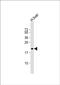 Rhophilin Associated Tail Protein 1 antibody, PA5-49502, Invitrogen Antibodies, Western Blot image 