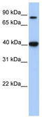 Sterol O-acyltransferase 1 antibody, TA336253, Origene, Western Blot image 