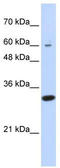 Leucine Rich Repeat Containing 57 antibody, TA330936, Origene, Western Blot image 