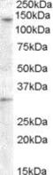 Probable G-protein coupled receptor 125 antibody, PA5-18934, Invitrogen Antibodies, Western Blot image 