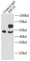 Eukaryotic Translation Initiation Factor 2A antibody, FNab02689, FineTest, Immunoprecipitation image 