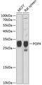 POP4 Homolog, Ribonuclease P/MRP Subunit antibody, A10082, Boster Biological Technology, Western Blot image 