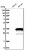 Homeobox A6 antibody, NBP1-83236, Novus Biologicals, Western Blot image 