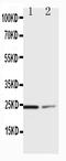 Suppressor Of Cytokine Signaling 1 antibody, PA1074, Boster Biological Technology, Western Blot image 