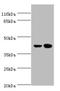 C-C Motif Chemokine Receptor 6 antibody, A50105-100, Epigentek, Western Blot image 