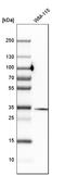 Monoglyceride Lipase antibody, HPA011993, Atlas Antibodies, Western Blot image 