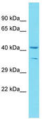 Coiled-Coil Domain Containing 189 antibody, TA334140, Origene, Western Blot image 