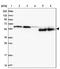 Regulator Of G Protein Signaling 11 antibody, PA5-59677, Invitrogen Antibodies, Western Blot image 