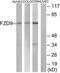 Frizzled Class Receptor 9 antibody, TA314730, Origene, Western Blot image 