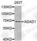 Adenosine Deaminase Domain Containing 1 antibody, A6491, ABclonal Technology, Western Blot image 