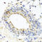 Mucin 16, Cell Surface Associated antibody, abx135924, Abbexa, Immunohistochemistry frozen image 