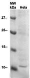 Small Ubiquitin Like Modifier 2 antibody, TA354223, Origene, Western Blot image 