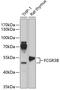 FcRIIIb antibody, 15-304, ProSci, Western Blot image 