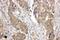 LIM and SH3 domain protein 1 antibody, PA1791, Boster Biological Technology, Immunohistochemistry paraffin image 