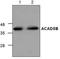 Acyl-CoA Dehydrogenase Short/Branched Chain antibody, TA318875, Origene, Western Blot image 