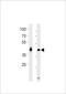 Homeobox D1 antibody, LS-C204015, Lifespan Biosciences, Western Blot image 