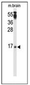 Protein Phosphatase 3 Regulatory Subunit B, Beta antibody, AP53423PU-N, Origene, Western Blot image 