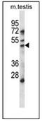 Histone Deacetylase 11 antibody, AP52023PU-N, Origene, Western Blot image 