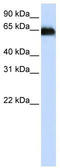 ADAM Metallopeptidase Domain 12 antibody, TA346008, Origene, Western Blot image 