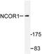 Nuclear Receptor Corepressor 1 antibody, AP06449PU-N, Origene, Western Blot image 
