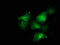 p130cas antibody, M00960-1, Boster Biological Technology, Immunofluorescence image 