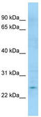 DNA dC->dU-editing enzyme APOBEC-3H antibody, TA337730, Origene, Western Blot image 