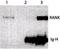 TNF Receptor Superfamily Member 11a antibody, TA337036, Origene, Western Blot image 