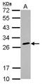 Major Histocompatibility Complex, Class II, DQ Beta 2 antibody, NBP2-14984, Novus Biologicals, Western Blot image 