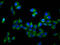 ADAM Metallopeptidase Domain 29 antibody, LS-C680122, Lifespan Biosciences, Immunofluorescence image 