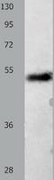 Solute Carrier Family 2 Member 1 antibody, TA322487, Origene, Western Blot image 