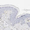 Plasminogen Activator, Tissue Type antibody, HPA003412, Atlas Antibodies, Immunohistochemistry frozen image 