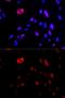 Checkpoint protein HUS1 antibody, GTX32662, GeneTex, Immunofluorescence image 