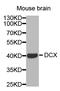 Doublecortin antibody, STJ23349, St John