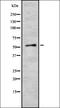 Zinc Finger Protein 768 antibody, orb335255, Biorbyt, Western Blot image 