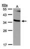Ras Association Domain Family Member 1 antibody, PA5-21322, Invitrogen Antibodies, Western Blot image 