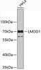 Leiomodin 1 antibody, 19-419, ProSci, Western Blot image 