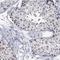 Bromodomain Containing 1 antibody, NBP1-88351, Novus Biologicals, Immunohistochemistry frozen image 