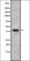 Choline-phosphate cytidylyltransferase A antibody, orb336930, Biorbyt, Western Blot image 