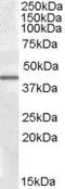 Calcium/Calmodulin Dependent Protein Kinase ID antibody, PA5-19089, Invitrogen Antibodies, Western Blot image 