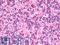 Glutamate Decarboxylase 2 antibody, LS-B9984, Lifespan Biosciences, Immunohistochemistry paraffin image 