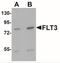 Fms Related Tyrosine Kinase 3 antibody, NBP2-41188, Novus Biologicals, Western Blot image 