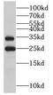 Myelin Protein Zero Like 2 antibody, FNab05301, FineTest, Western Blot image 