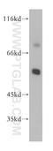 GnT-IVc antibody, 17841-1-AP, Proteintech Group, Western Blot image 