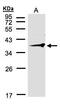 Ring Finger Protein 2 antibody, GTX106431, GeneTex, Western Blot image 