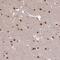 Suppression Of Tumorigenicity 5 antibody, NBP2-13391, Novus Biologicals, Immunohistochemistry paraffin image 