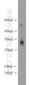 Coiled-Coil Domain Containing 70 antibody, 21558-1-AP, Proteintech Group, Western Blot image 