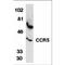 C-C Motif Chemokine Receptor 5 (Gene/Pseudogene) antibody, TA305941, Origene, Western Blot image 