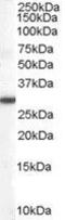 Dimethylarginine Dimethylaminohydrolase 2 antibody, GTX21383, GeneTex, Western Blot image 